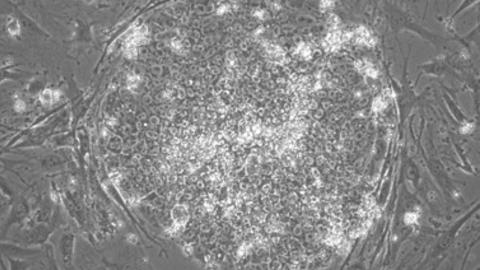 Brightfield micrograph of a newly reprogrammed iPSC colony