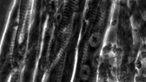 Micrograph of stem cell-derived skeletal muscle