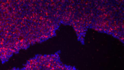 Fluorescence micrograph of iPSCs stained for TRA-1-60