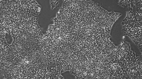 Phase contrast micrograph of iPSC culture